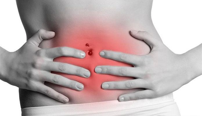 how-to-find-out-what-s-making-your-stomach-hurt-using-this-belly-map