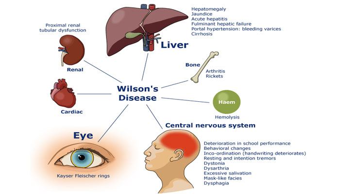 understanding-elevated-liver-enzymes