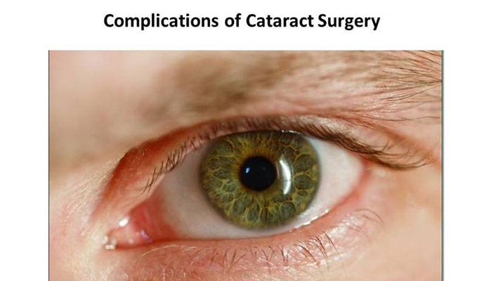 Is cataract surgery dangerous