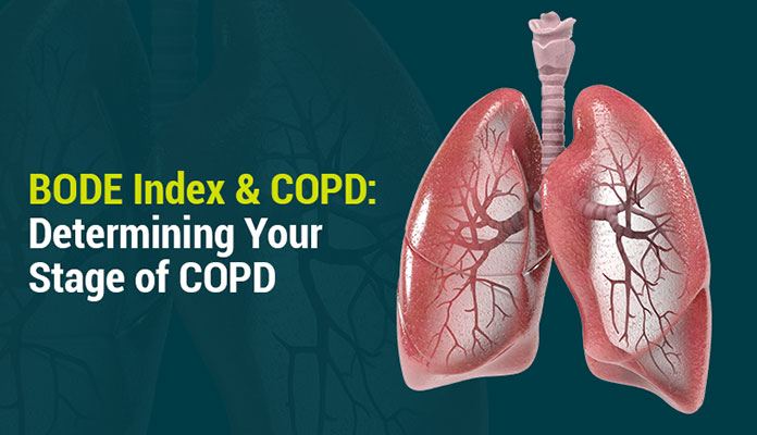 COPD Stages Prognosis, Treatments & Life Expectancy New