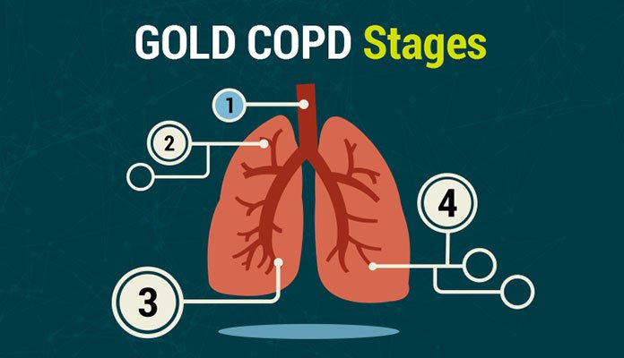 Copd Stages Prognosis Treatments And Life Expectancy New Life Ticket