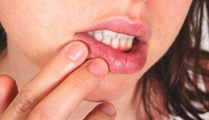 what-causes-your-tongue-and-lips-to-burn-lipstutorial