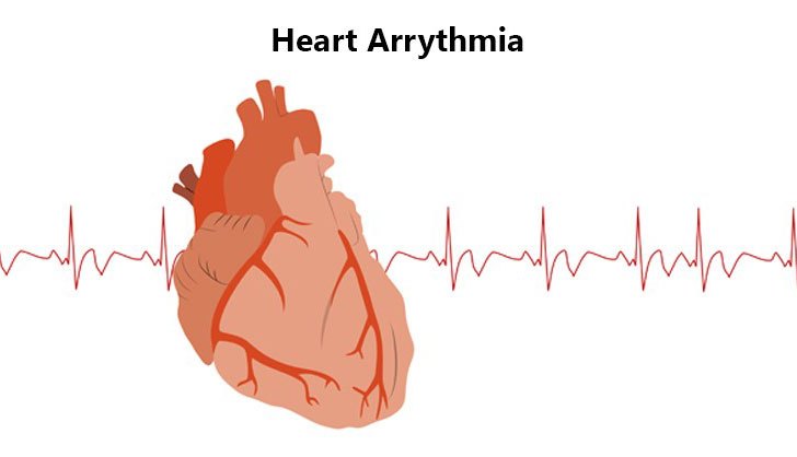 Hypocalcemia – Causes, Symptoms & Treatments | New Life Ticket - Part 10