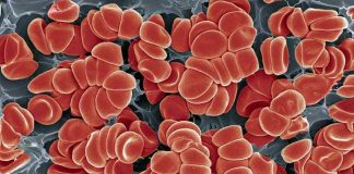 platelet causes