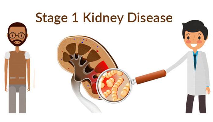 Kidney Disease – 5 Stages and Life Expectancy – Page 3 – New Life Ticket