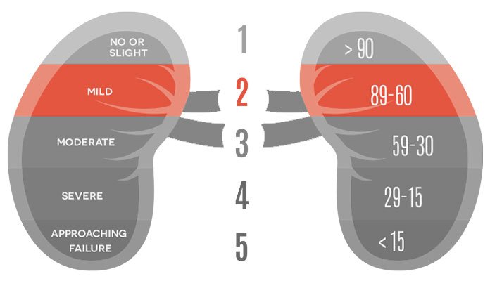 kidney-disease-5-stages-and-life-expectancy-new-life-ticket-part-4