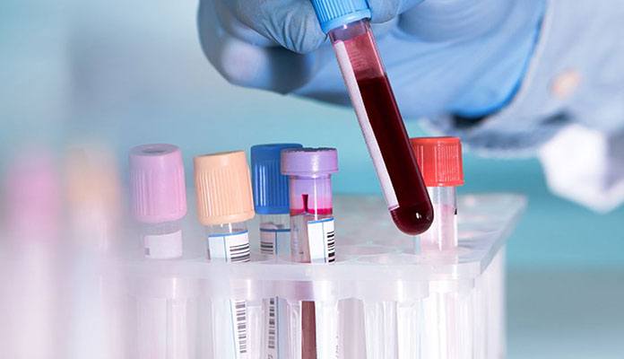 new-blood-test-helps-detect-heart-attack-much-faster