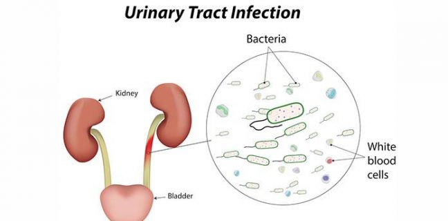 Urology | New Life Ticket