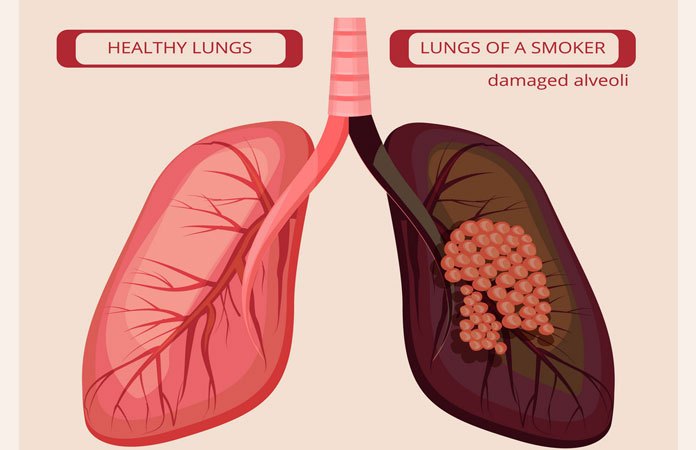 10-impacts-of-smoking-for-the-body-new-life-ticket