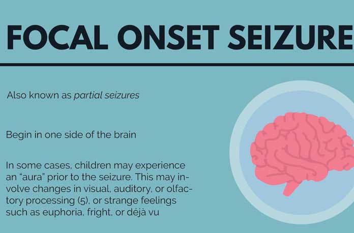 Partial Seizures (Focal Seizures) Guide – 10 Facts to Know – New Life ...