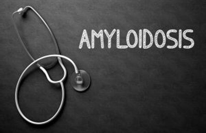 Amyloidosis Prognosis & Life Expectancy – New Life Ticket