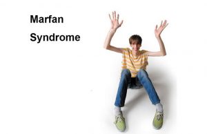 What is Marfan Syndrome? – New Life Ticket