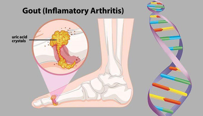 Foot Pain Diagnosis – What’s Causing Your Pain – Page 5 – New Life Ticket