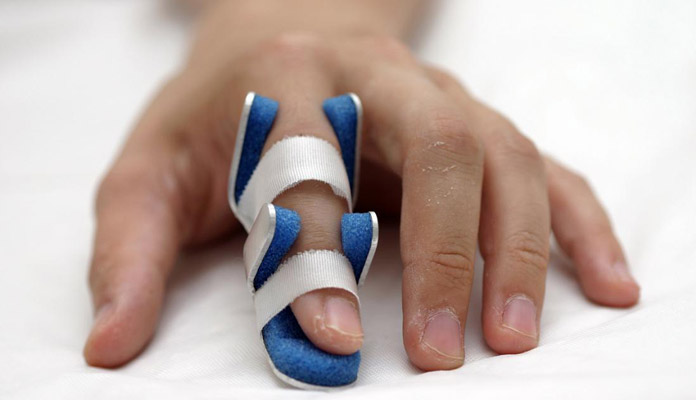 compression fracture treatment finger