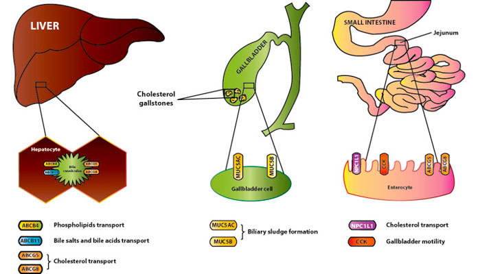 10 Facts of Choledocholithiasis – Page 3 – New Life Ticket