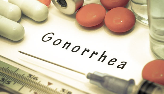 Gonorrhea Diagnosis And Treatment Page 6 New Life Ticket