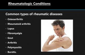 upper arm pain causes        
        <figure class=