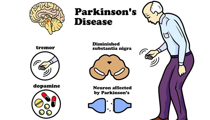 What Causes Parkinson’s Disease – New Life Ticket