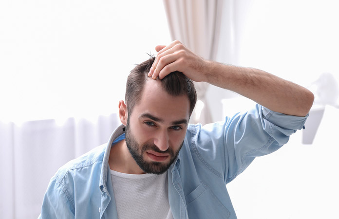 Hair Loss in Men – Causes and Treatments | New Life Ticket - Part 3