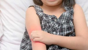 Heat Rash in Infants and Children | New Life Ticket