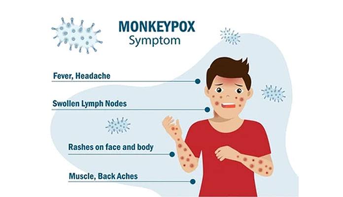 What is Monkeypox – Symptoms, Transmission, Treatments & Prevention ...